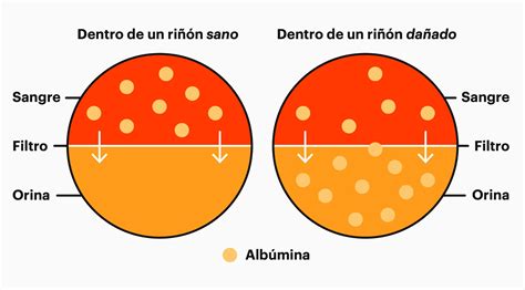 Proteina En La Orina