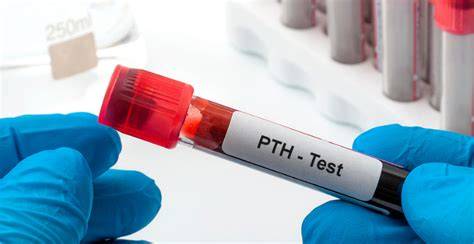 Pth Laboratory Test