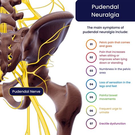 Pudendal Neuralgia Symptoms