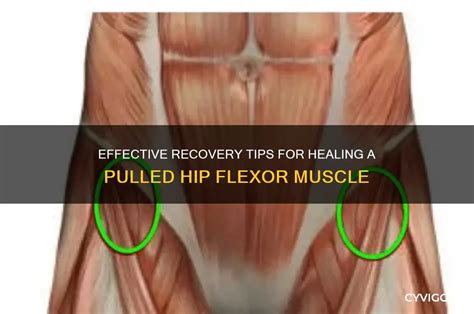 Pulled Hip Muscle
