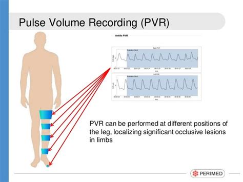 Pulse Volume Recording