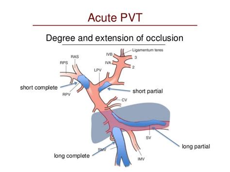 Pvt Medical Abbreviation