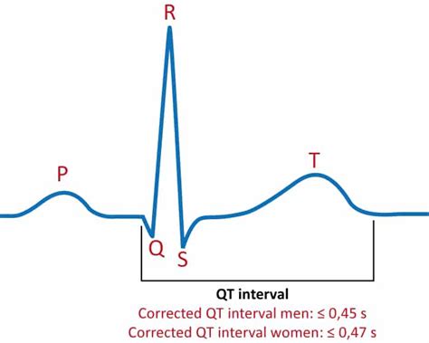 Qt Length Ecg