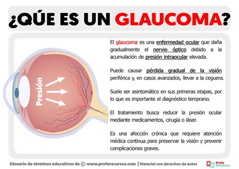 Que Es Glaucoma