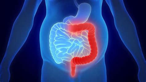 Que Es La Colitis