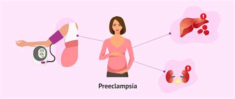 Que Es La Preeclampsia