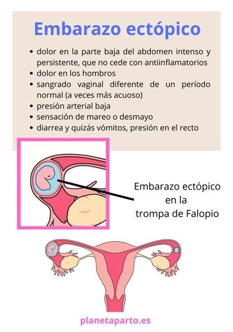 Que Es Un Embarazo Ectopico