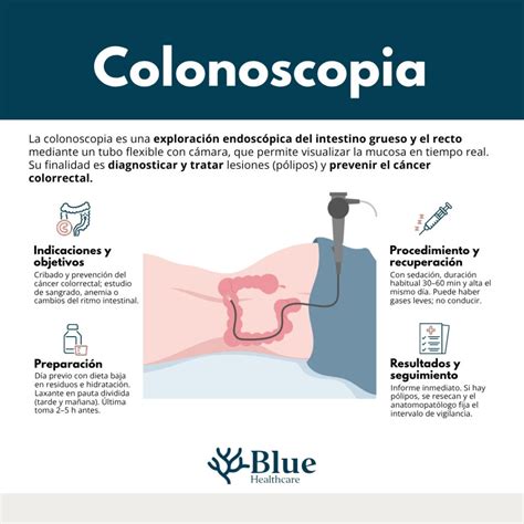Que Es Una Colonoscopia