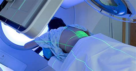 Radiation For Skin Cancer