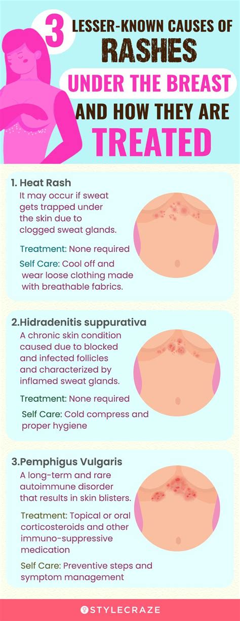 Rash Between Breasts