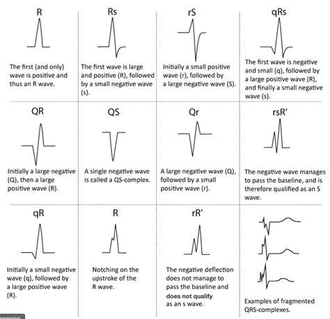 Rate Of Qrs Complex