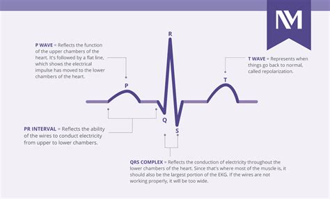 Reading An Ekg