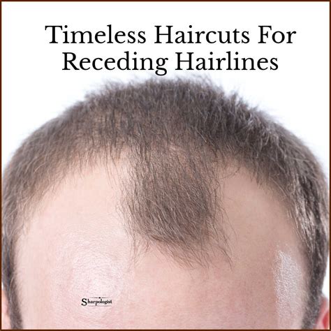Receding Hairline Men