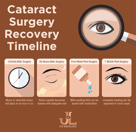 Recovery Time For Cataract Surgery