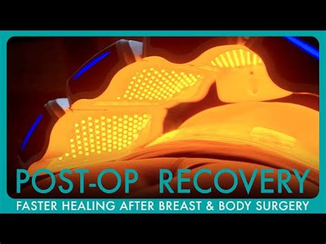 Recovery Time For Mastopexy