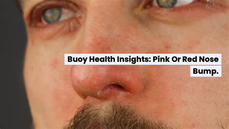 Red Bump On Nose