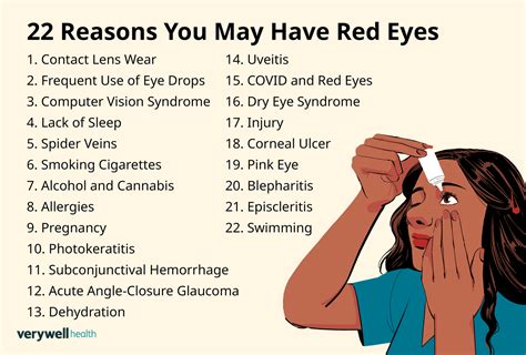 Red Eye Causes