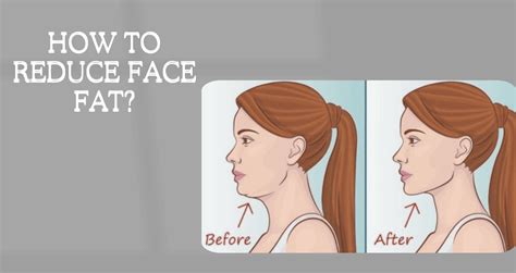 Reduce Face Fat Surgery