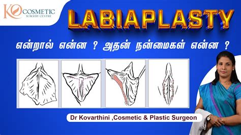 Reduction Of Labia