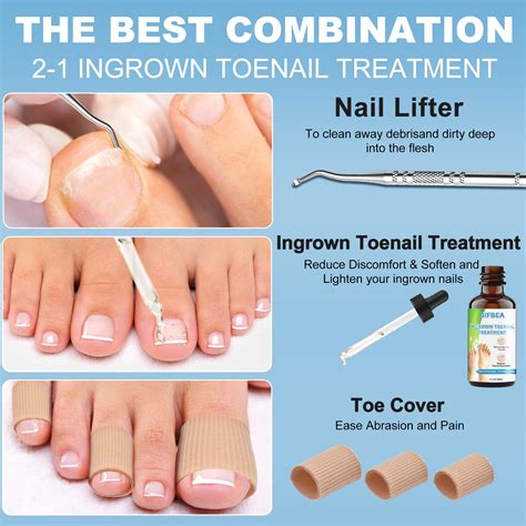 Remedies For Ingrown Nail