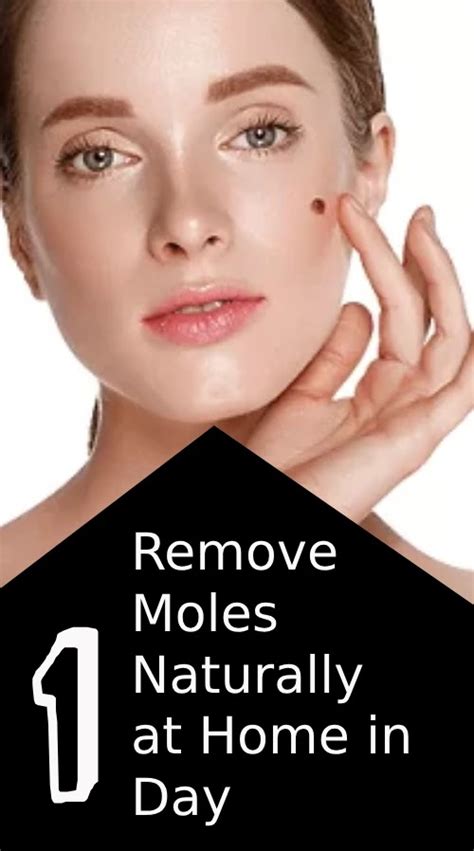 Remove Moles At Home
