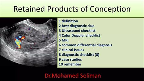 Retained Products Of Conception