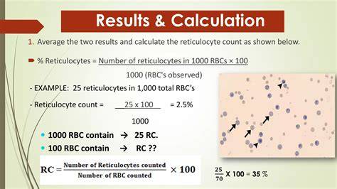 Reticular Count Normal