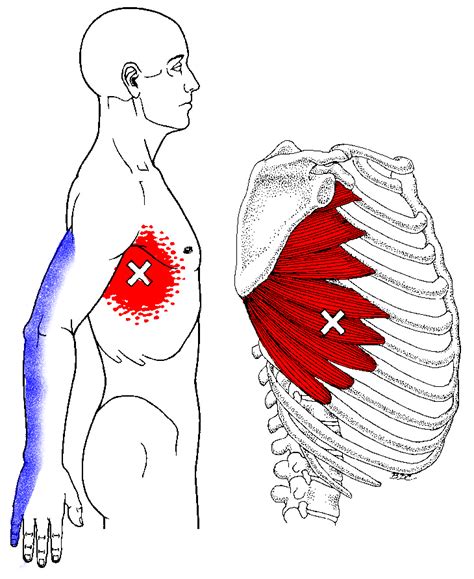 Rib Pain Sharp