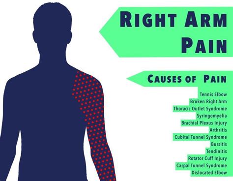 Right Arm Pain