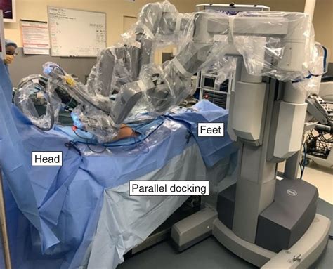 Robotic Inguinal Hernia Repair