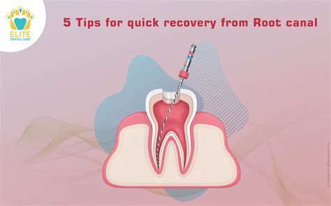 Root Canal Recovery