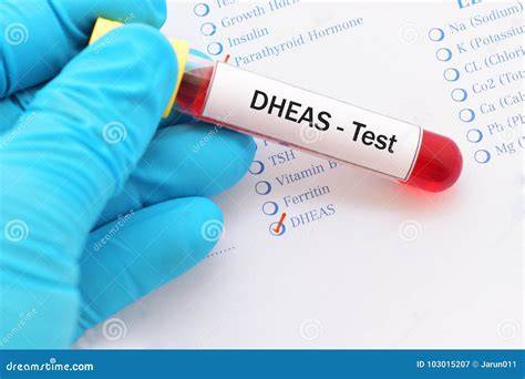 S Dheas Blood Test