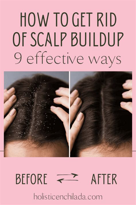 Scalp Build Up