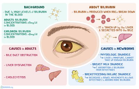 Sclera Are Anicteric