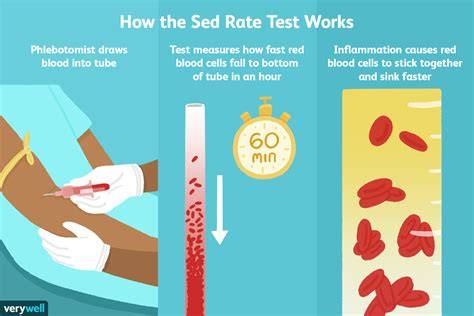 Sed Rate Erythrocyte Automated