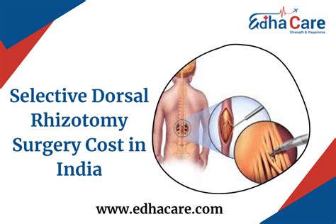 Selective Dorsal Rhizotomy