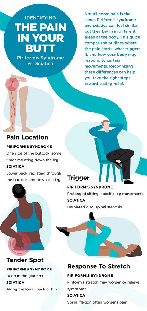 Sharp Pain In Butt