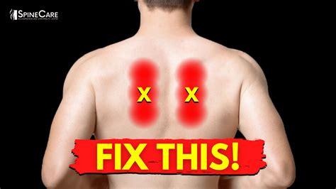 Sharp Pain In Shoulder Blade