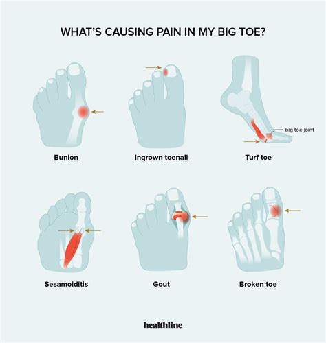 Sharp Pain In Toes