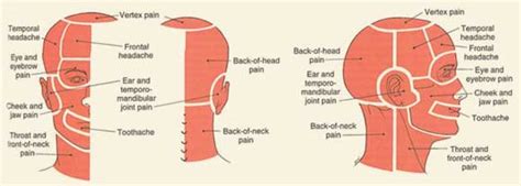 Shooting Pain In Head