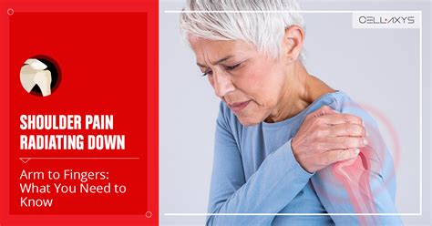 Shoulder Pain Radiating Down Arm
