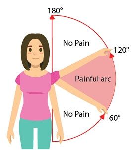 Shoulder Pain When Raising Arm