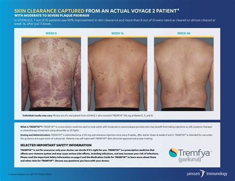 Side Effects Of Tremfya