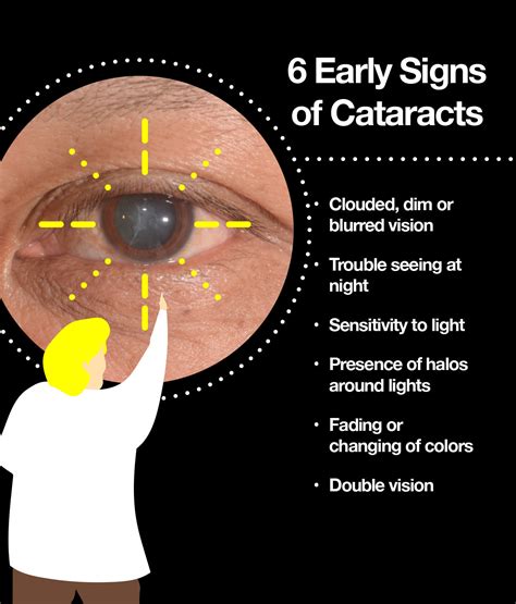 Sign Symptoms Of Cataract