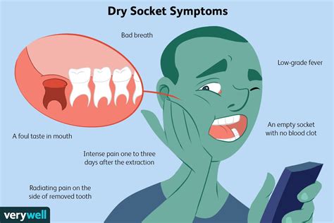 Signs Of A Dry Socket