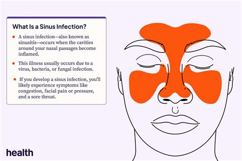 Signs Of A Sinus Infection