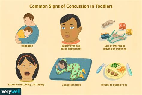 Signs Of Concussion In Toddler