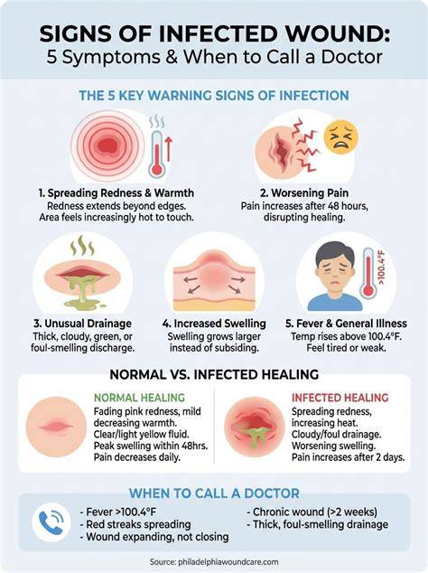 Signs Of Infected Wound