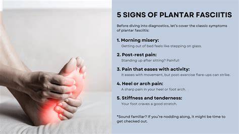 Signs Of Plantar Fasciitis