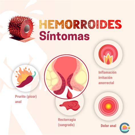 Sintomas De Hemorroides